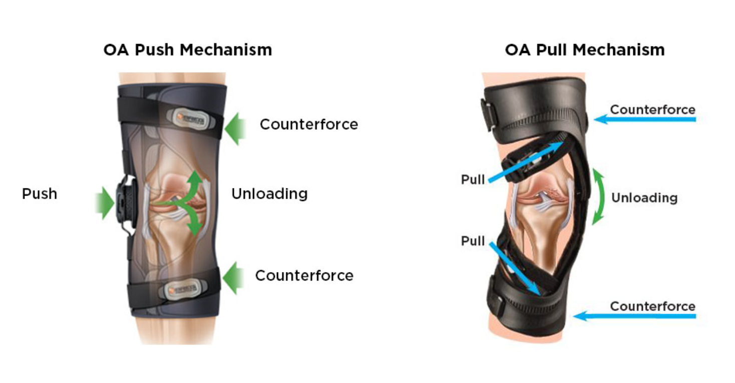 Braces for Knee Osteoarthritis / OA Knee Pain