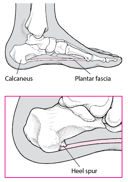 How to Relieve HEEL PAIN in Seconds - YouTube